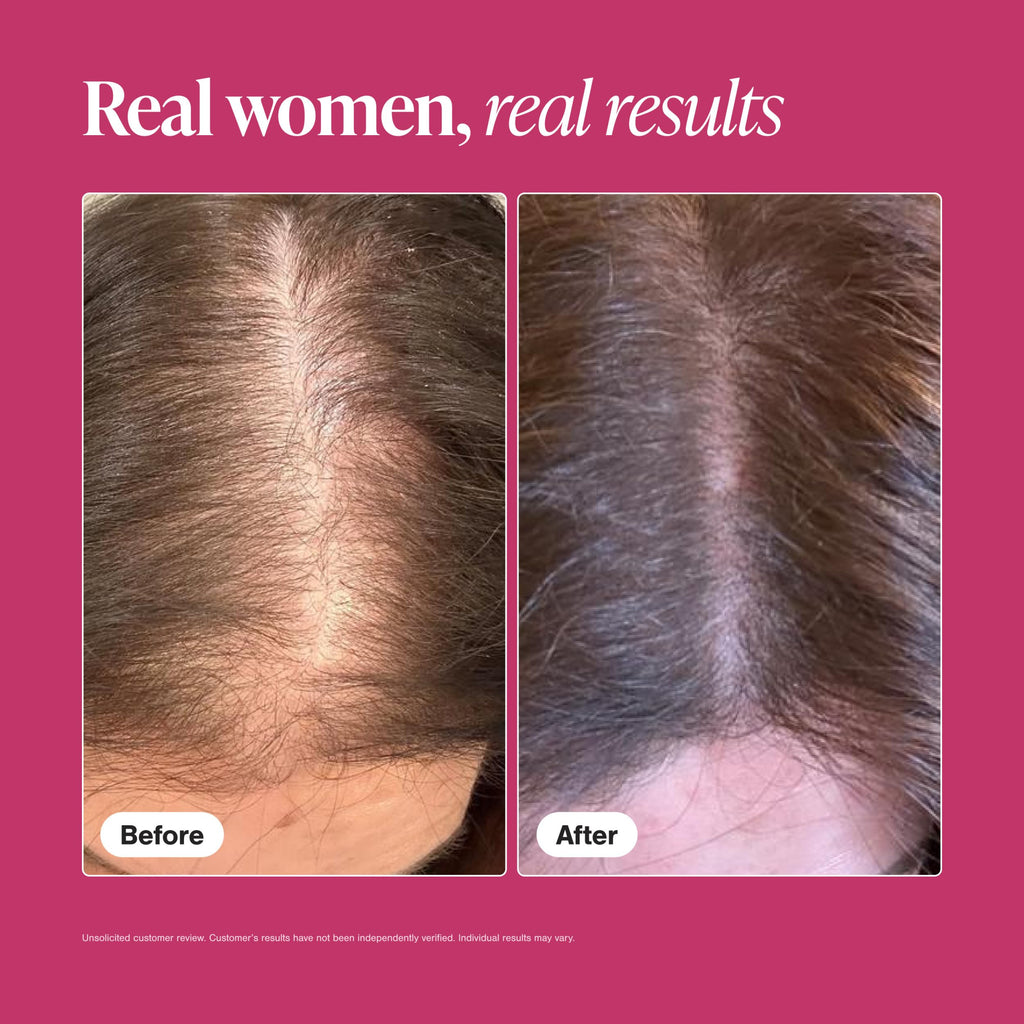 Hair Growth Supplements for Women, 60 Tablets P1100